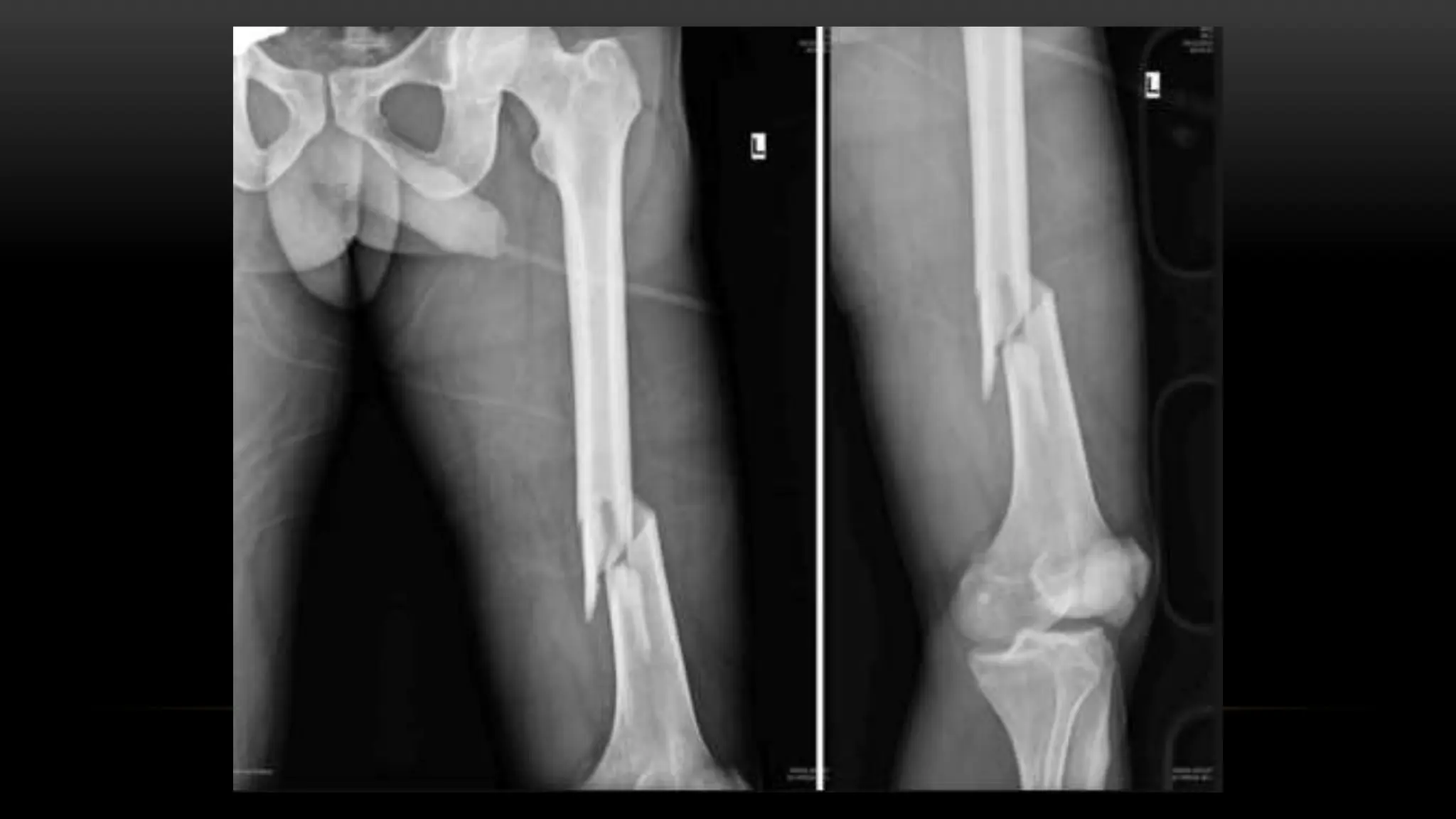 SISTEMA MUSCULOESQUELETICO EN RADIOGRAFIA